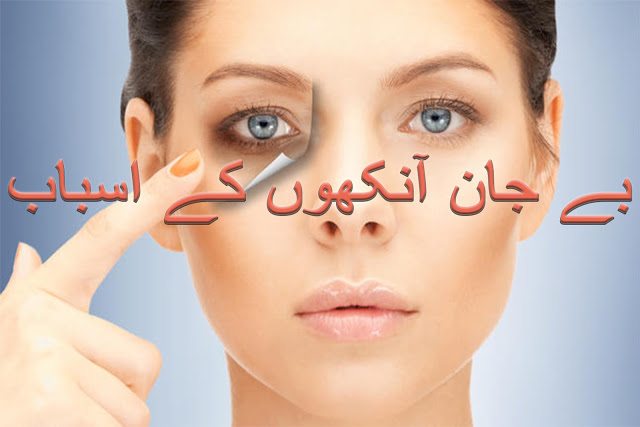 eye strain symptoms in urdu and hindi