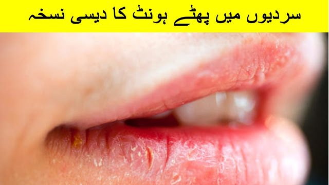 How to Get Rid of Painful Cracked Lips in urdu and hindi