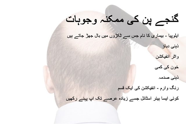 Seven Causes of Baldness in urdu and hindi - Ganja pan ki mumkina wajoohat