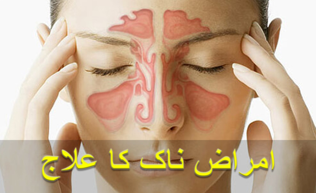 Home remedies for sinus and allergies in urdu 1