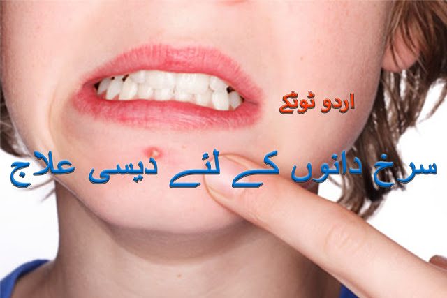 How to Remove Acne and Pimples From Face in Urdu