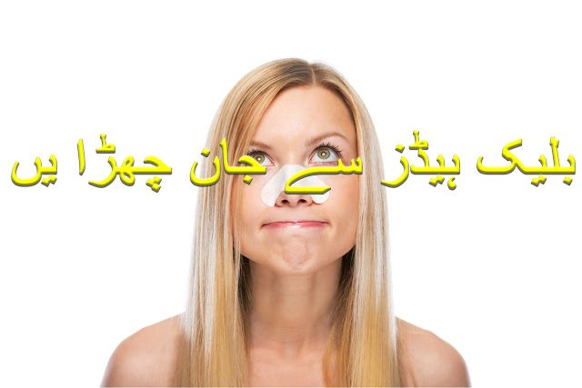 BlackHeads Removal Tips in urdu and hindi
