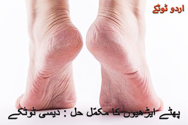 Simple and effective Urdu home remedies for cracked heels 