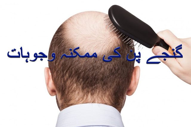 Causes of baldness for men and women in urdu and hindi 
