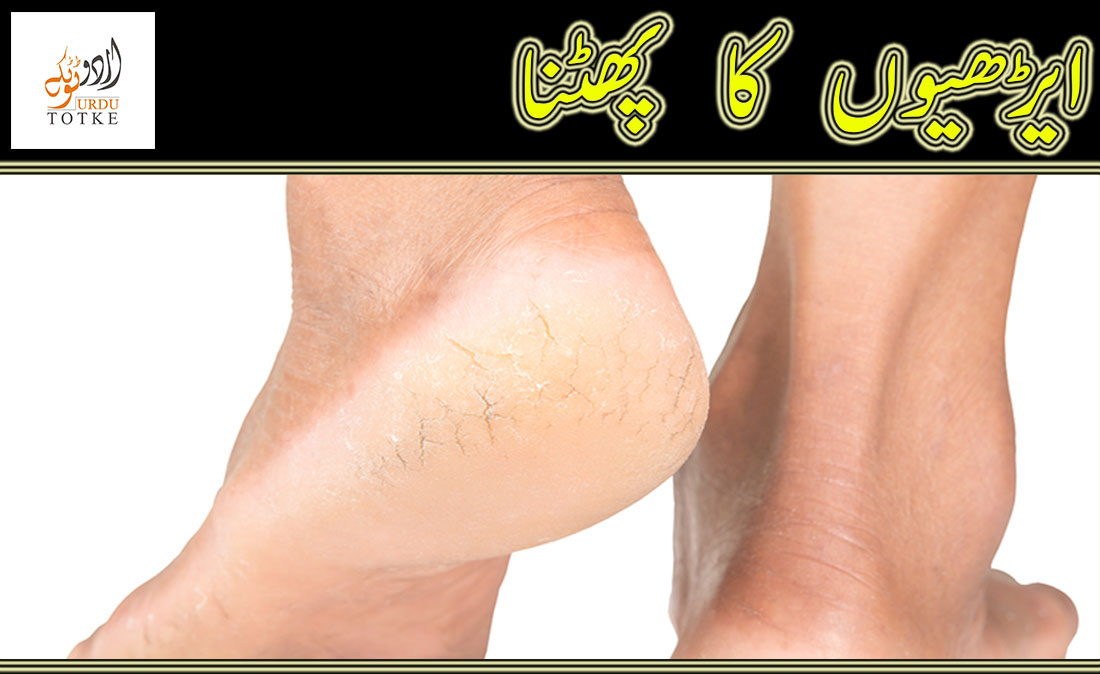 crack heels home remedy in urdu