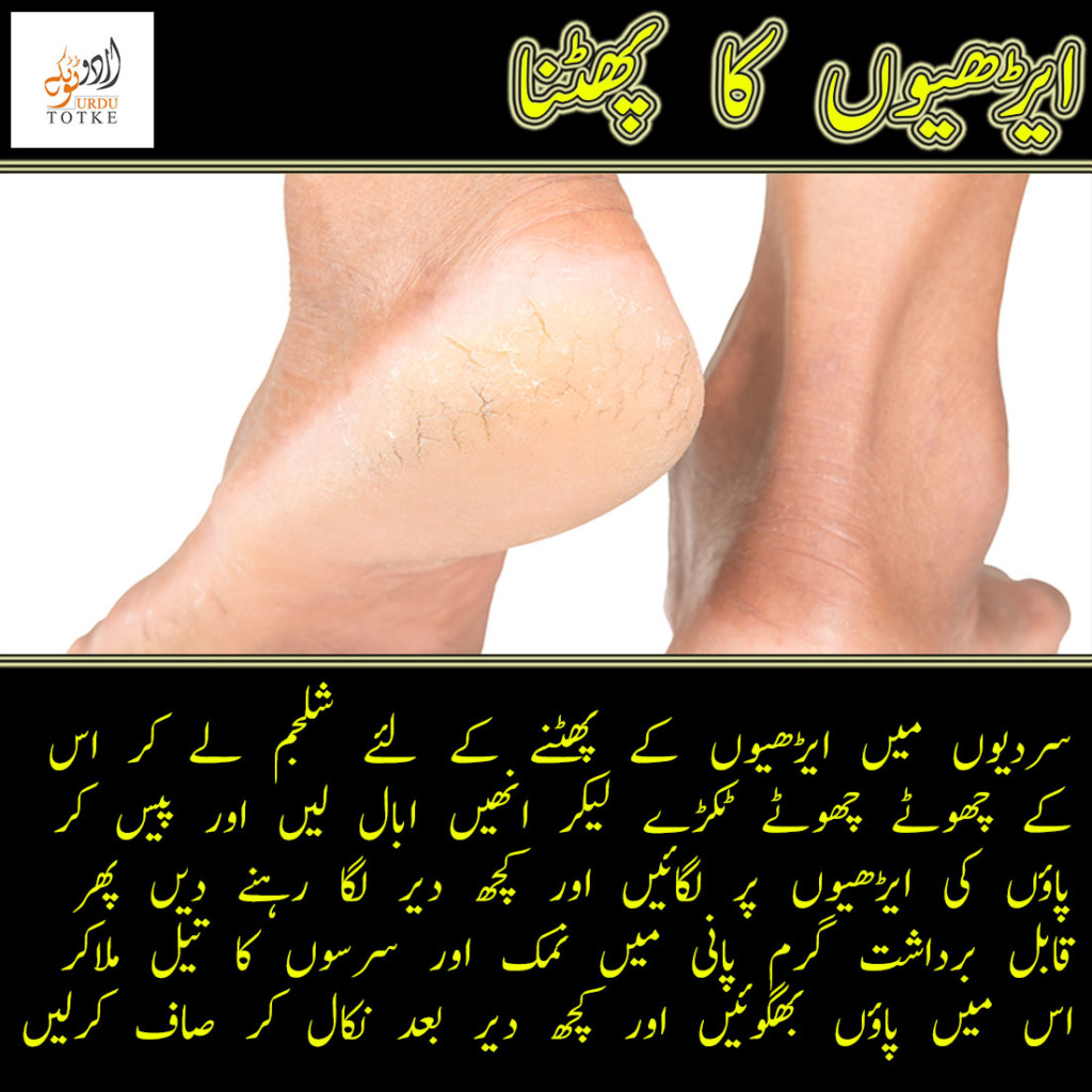 cracked heels treatment in urdu